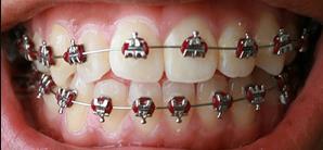 teeth
