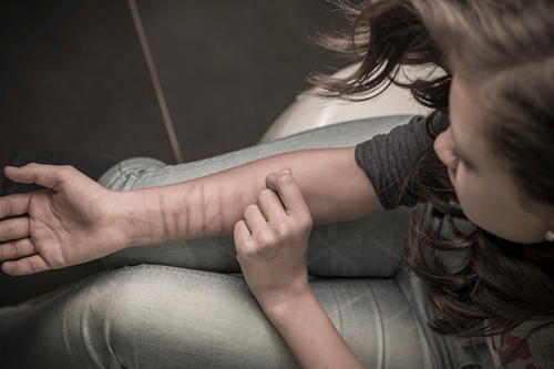 Self harming teenager