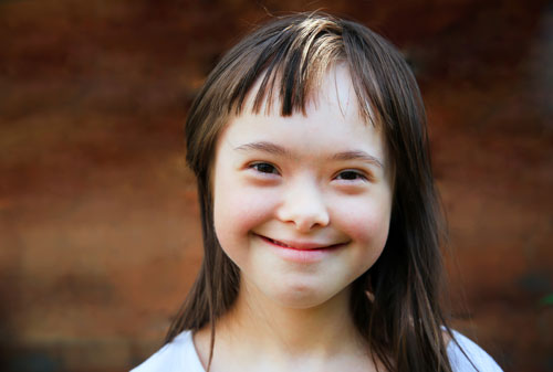 Down syndrome