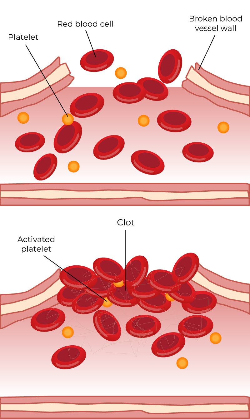 Clot Science Blended Learning
